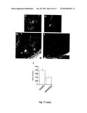 METHOD OF DETECTING A CANCER CELL BY ABERRANT EXPRESSION OF A HUMAN K+ ION CHANNEL diagram and image