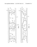 ASYMMETRIC DOVETAIL INTERCONNECT FOR SOLID OXIDE FUEL CELL diagram and image