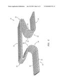 ASYMMETRIC DOVETAIL INTERCONNECT FOR SOLID OXIDE FUEL CELL diagram and image