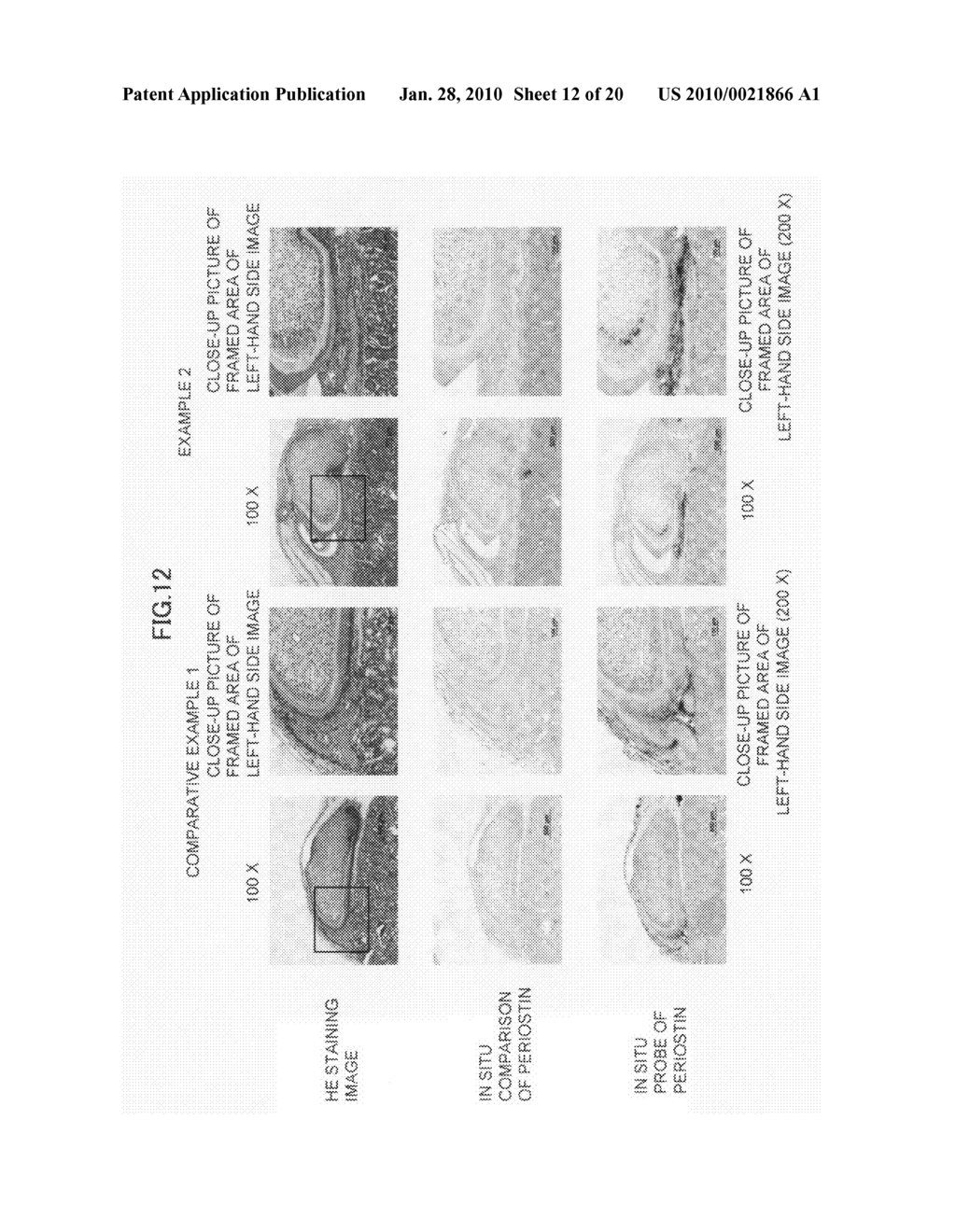 Method of producing tooth, set of teeth, and method of producing tissue - diagram, schematic, and image 13