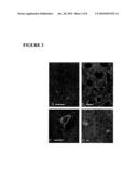 DETECTION OF A BIOMARKER OF ABERRANT CELLS OF NEUROECTODERMAL ORIGIN IN A BODY FLUID diagram and image