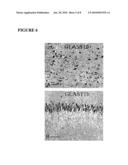 DETECTION OF A BIOMARKER OF ABERRANT CELLS OF NEUROECTODERMAL ORIGIN IN A BODY FLUID diagram and image