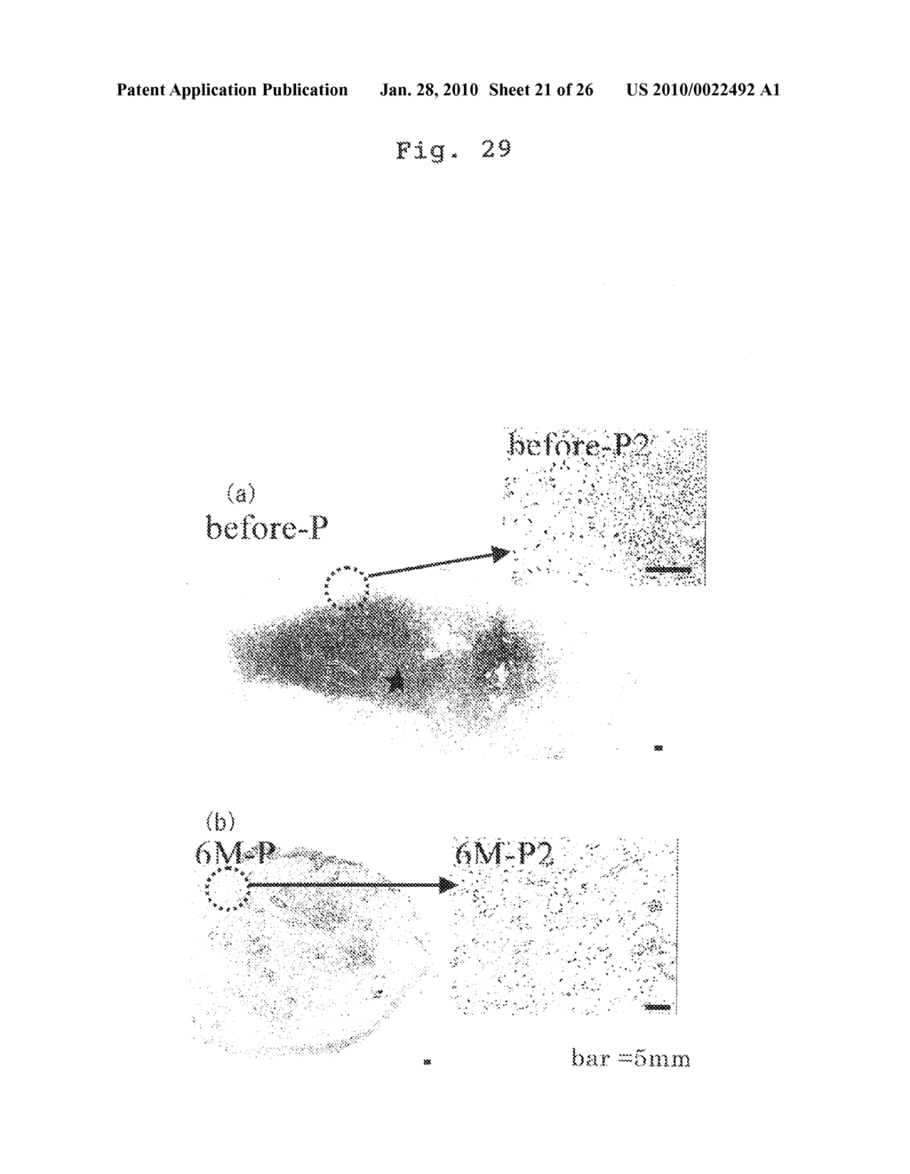 THERAPEUTIC CAUSING CONTRACTION OF MUCOSAL TISSUE, METHOD OF TREATING DISEASES RELATING TO MUCOSAL TISSUES, INJECTOR AND THERAPEUTIC SET - diagram, schematic, and image 22