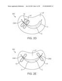 METHODS AND DEVICES FOR TISSUE GRASPING AND ASSESSMENT diagram and image