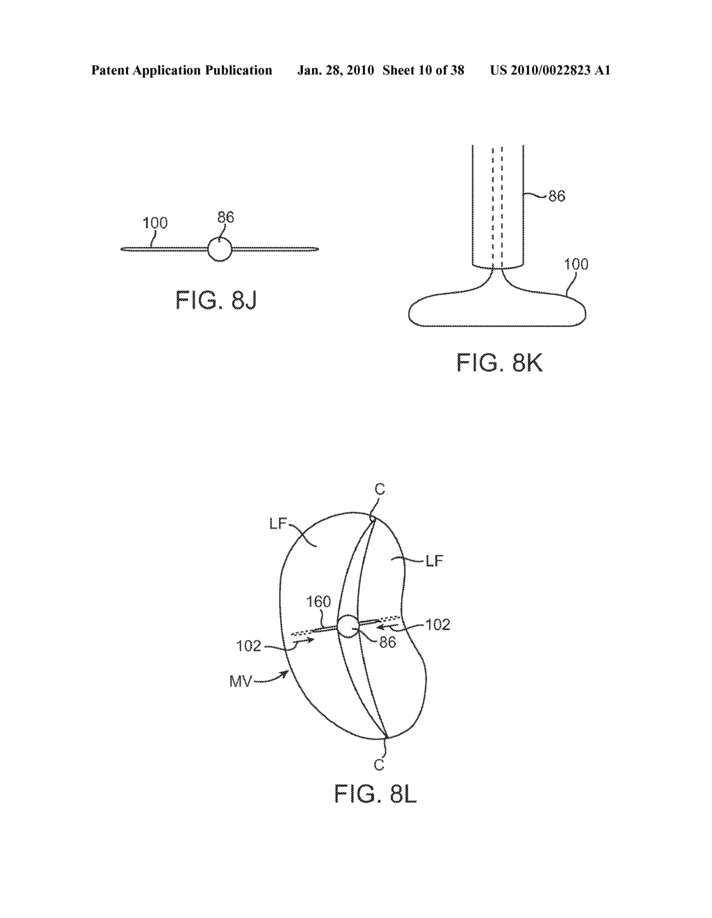 METHODS AND DEVICES FOR TISSUE GRASPING AND ASSESSMENT - diagram, schematic, and image 11