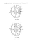 METHODS AND DEVICES FOR TISSUE GRASPING AND ASSESSMENT diagram and image