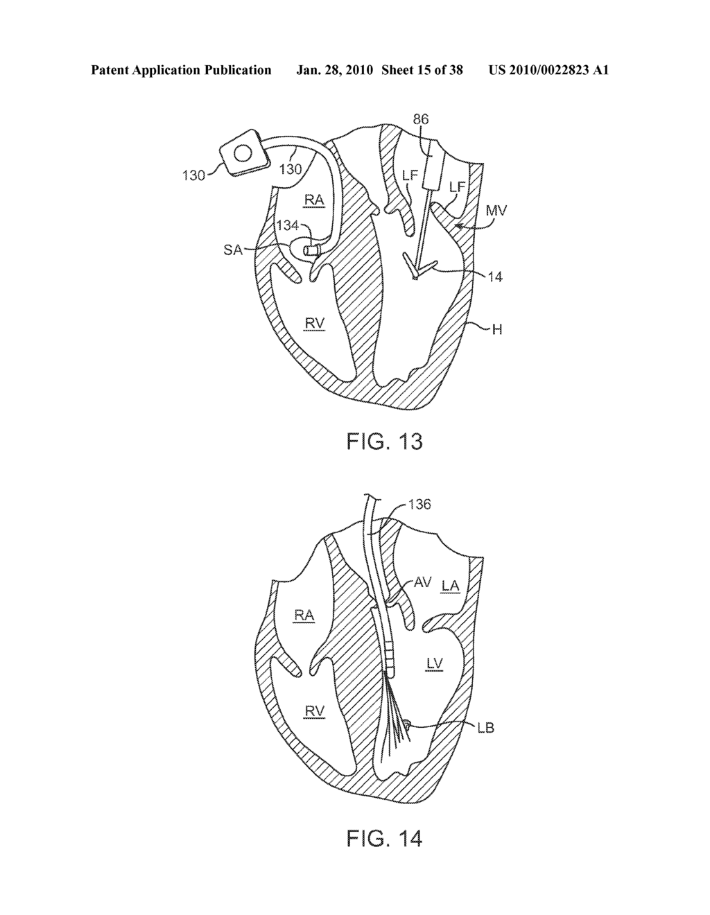 METHODS AND DEVICES FOR TISSUE GRASPING AND ASSESSMENT - diagram, schematic, and image 16