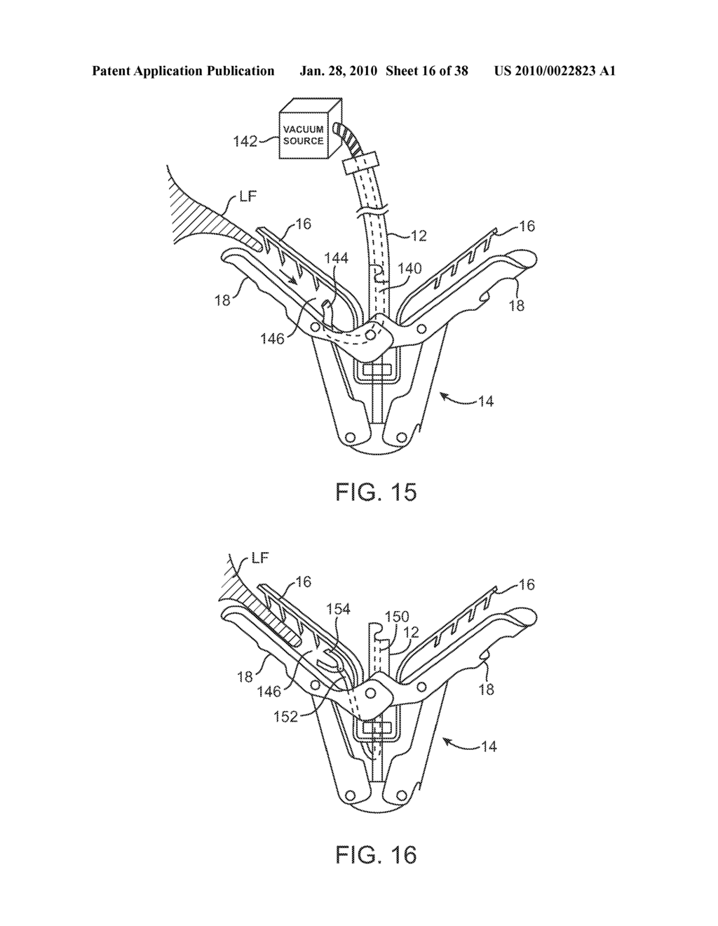 METHODS AND DEVICES FOR TISSUE GRASPING AND ASSESSMENT - diagram, schematic, and image 17