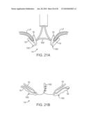 METHODS AND DEVICES FOR TISSUE GRASPING AND ASSESSMENT diagram and image