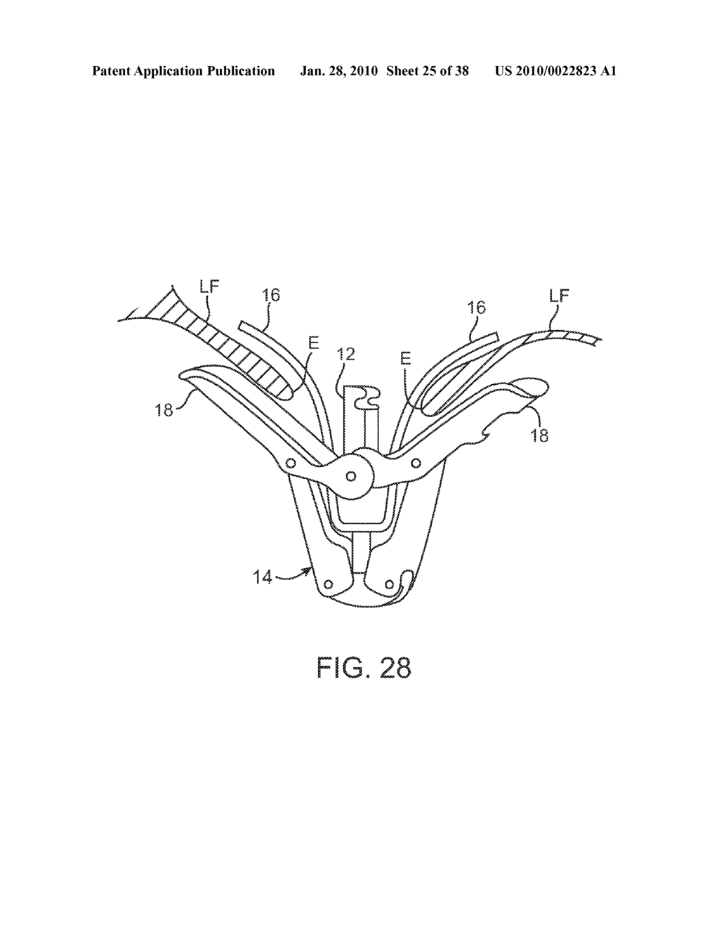 METHODS AND DEVICES FOR TISSUE GRASPING AND ASSESSMENT - diagram, schematic, and image 26