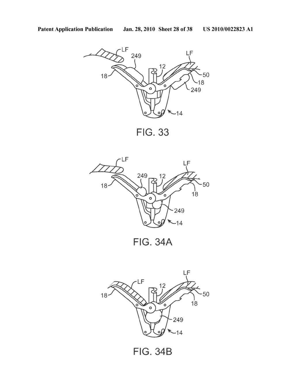 METHODS AND DEVICES FOR TISSUE GRASPING AND ASSESSMENT - diagram, schematic, and image 29