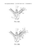 METHODS AND DEVICES FOR TISSUE GRASPING AND ASSESSMENT diagram and image