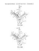 METHODS AND DEVICES FOR TISSUE GRASPING AND ASSESSMENT diagram and image