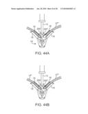 METHODS AND DEVICES FOR TISSUE GRASPING AND ASSESSMENT diagram and image