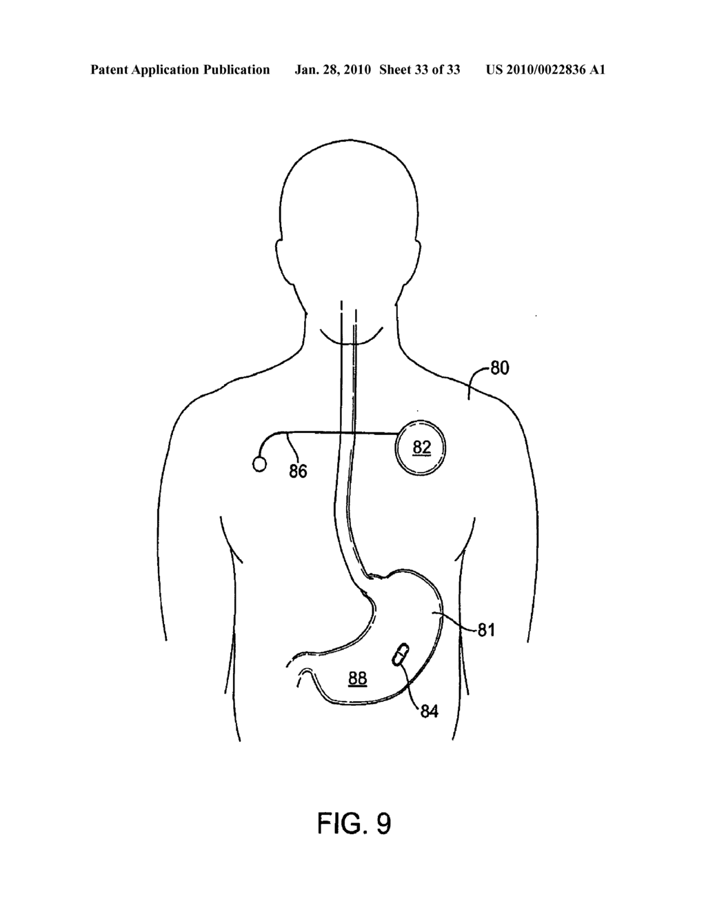 IN-BODY DEVICE HAVING A MULTI-DIRECTIONAL TRANSMITTER - diagram, schematic, and image 34