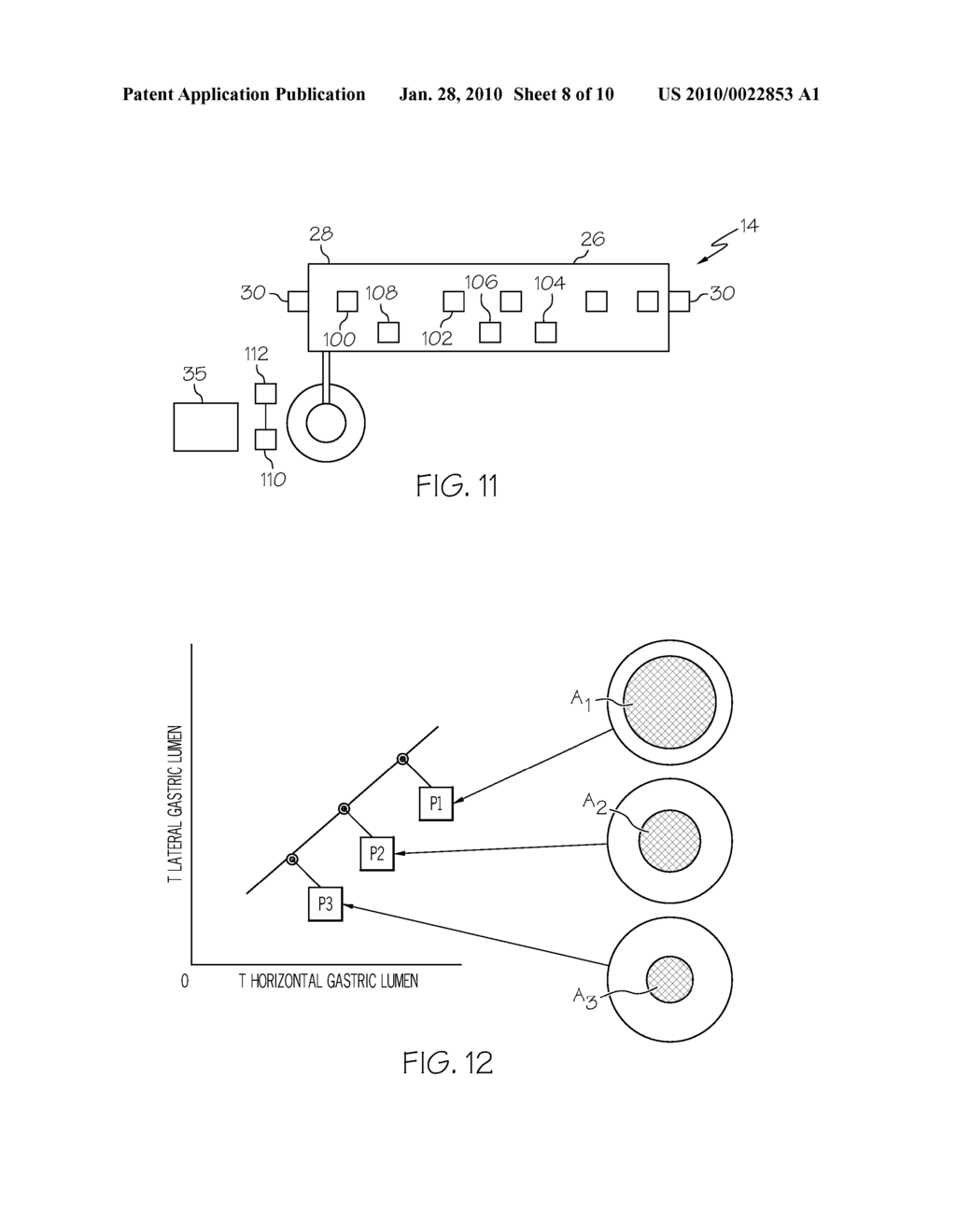 Device for Monitoring Size of Luminal Cavity - diagram, schematic, and image 09