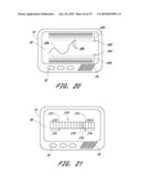 SIGNAL PROCESSING FOR CONTINUOUS ANALYTE SENSOR diagram and image