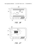 SIGNAL PROCESSING FOR CONTINUOUS ANALYTE SENSOR diagram and image