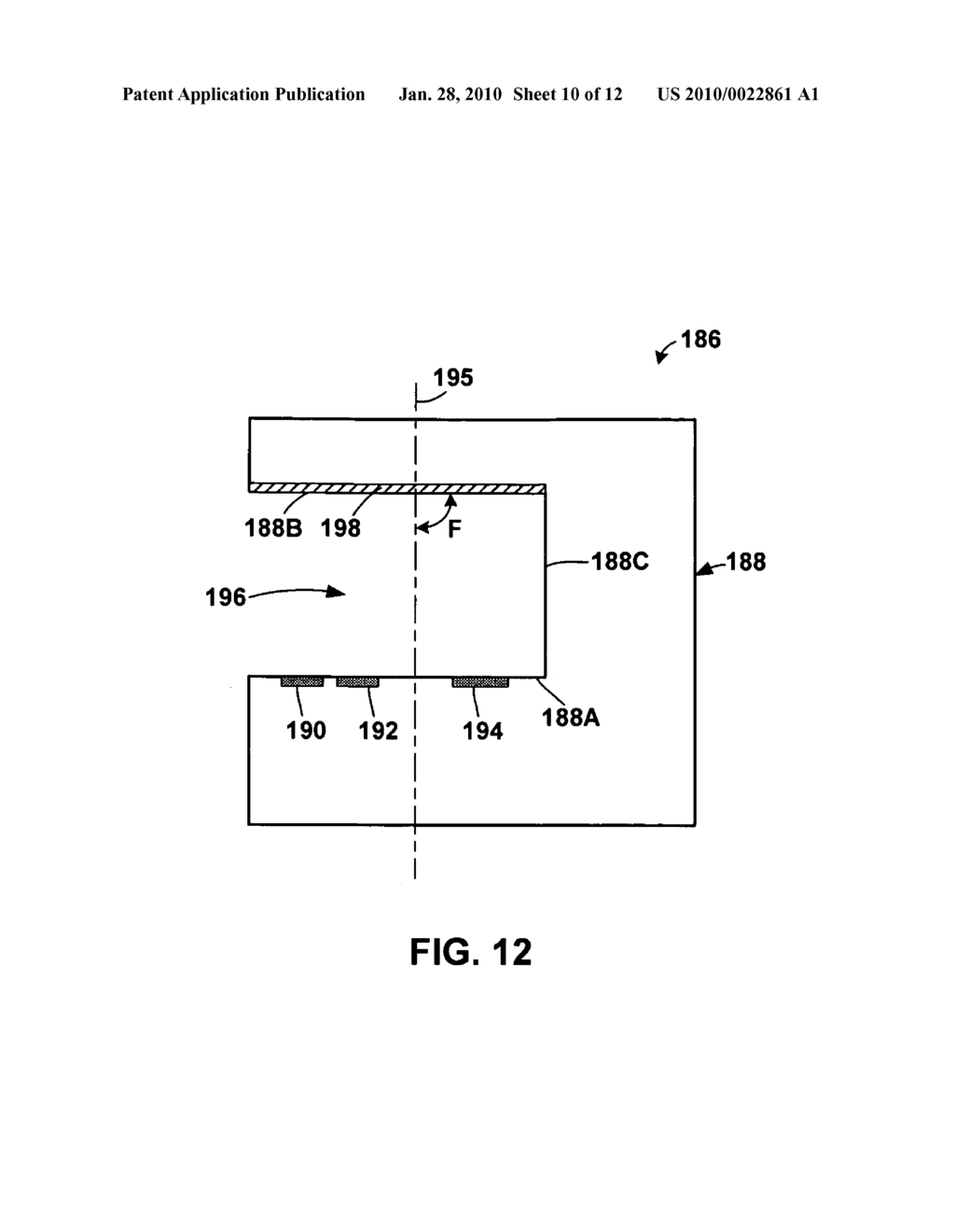 IMPLANTABLE OPTICAL HEMODYNAMIC SENSOR INCLUDING AN EXTENSION MEMBER - diagram, schematic, and image 11