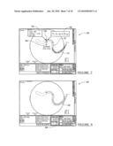 Navigation System for Cardiac Therapies diagram and image