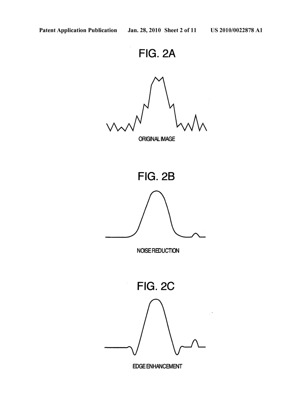 Ultrasonic Image Processor - diagram, schematic, and image 03