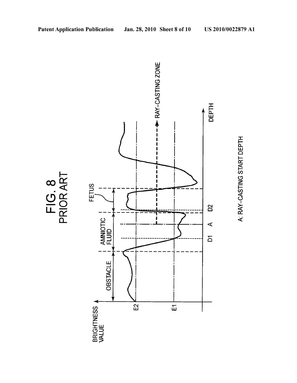 ULTRASONIC DIAGNOSTIC DEVICE - diagram, schematic, and image 09