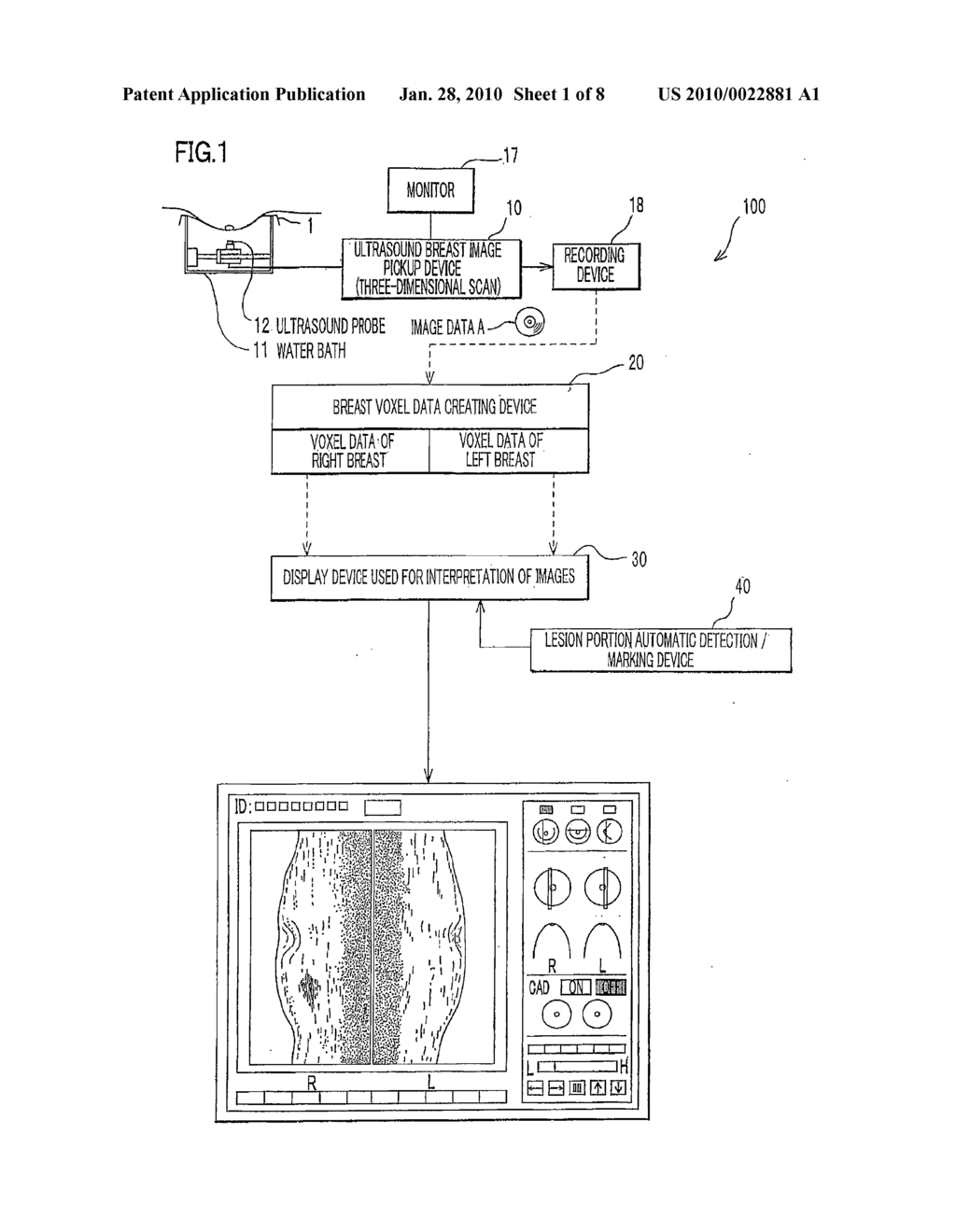 Ultrasound Breast Diagnostic System - diagram, schematic, and image 02