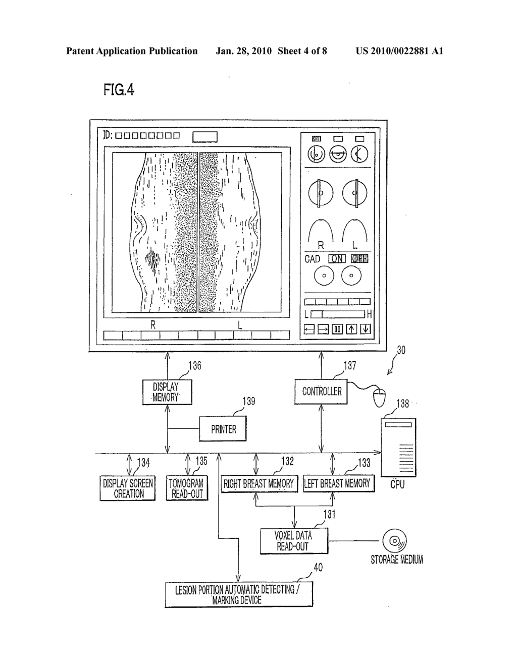 Ultrasound Breast Diagnostic System - diagram, schematic, and image 05