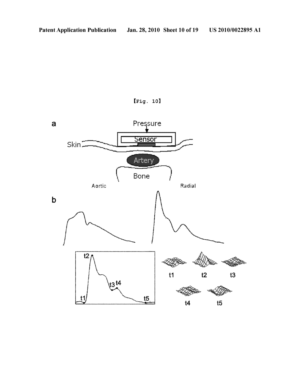 DIAGNOSIS SYSTEM OF DEFICIENT AND FORCEFUL PULSE - diagram, schematic, and image 11