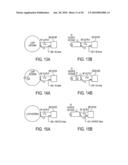 VENTRICULAR SHUNT SYSTEM AND METHOD diagram and image