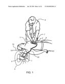 CPR ASSIST DEVICE FOR MEASURING COMPRESSION VARIABLES DURING CARDIOPULMONARY RESUSCITATION diagram and image