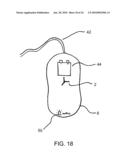 CPR ASSIST DEVICE FOR MEASURING COMPRESSION VARIABLES DURING CARDIOPULMONARY RESUSCITATION diagram and image