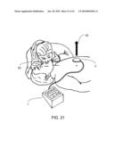 CPR ASSIST DEVICE FOR MEASURING COMPRESSION VARIABLES DURING CARDIOPULMONARY RESUSCITATION diagram and image