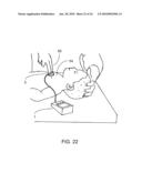 CPR ASSIST DEVICE FOR MEASURING COMPRESSION VARIABLES DURING CARDIOPULMONARY RESUSCITATION diagram and image