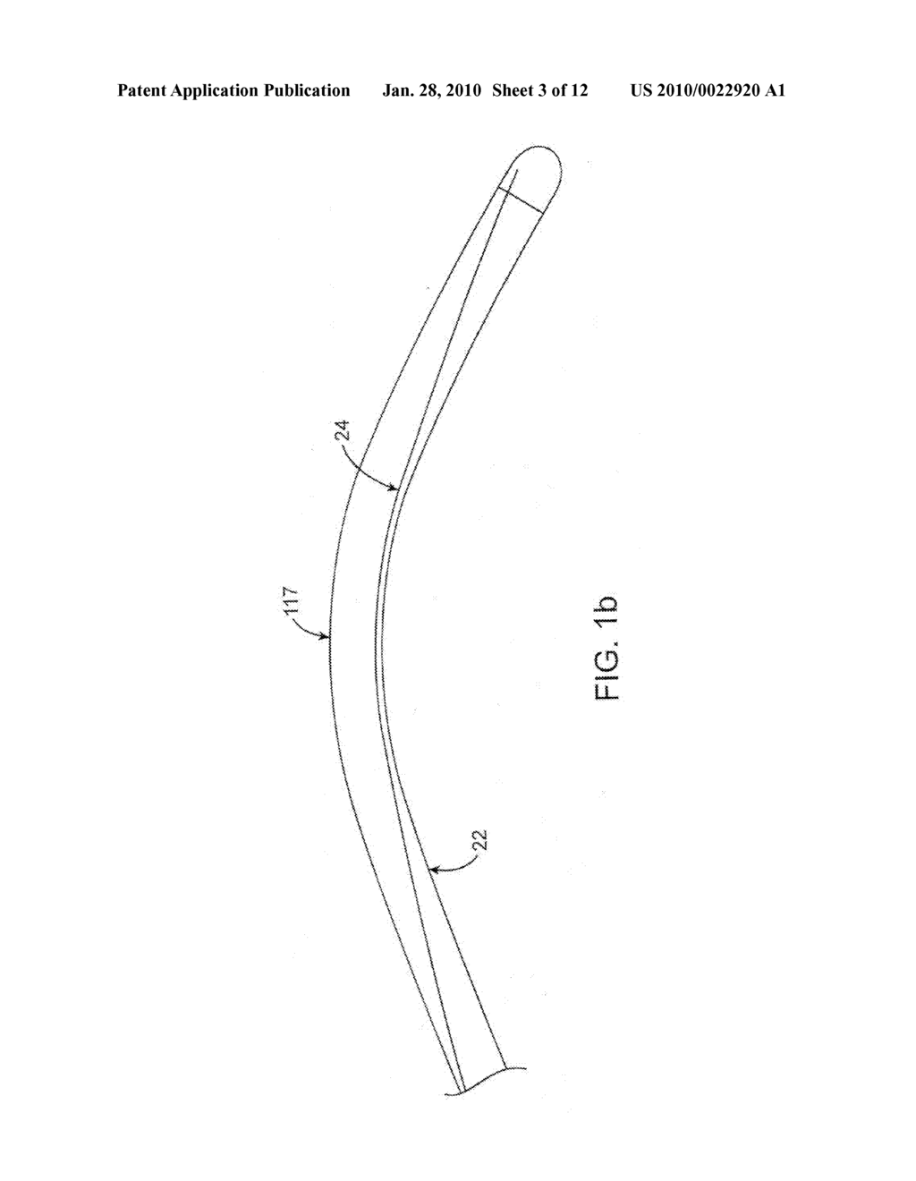 ULTRASOUND CATHETER AND METHODS FOR MAKING AND USING SAME - diagram, schematic, and image 04