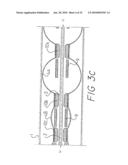 INFLATABLE CHAMBER DEVICE FOR MOTION THROUGH A PASSAGE diagram and image