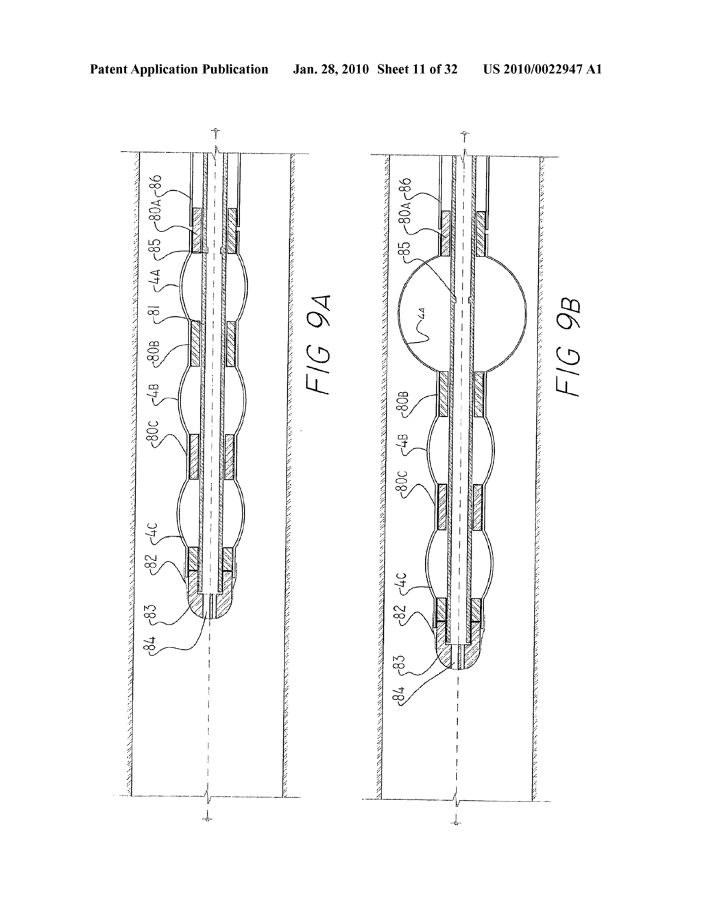 INFLATABLE CHAMBER DEVICE FOR MOTION THROUGH A PASSAGE - diagram, schematic, and image 12