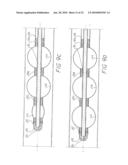 INFLATABLE CHAMBER DEVICE FOR MOTION THROUGH A PASSAGE diagram and image