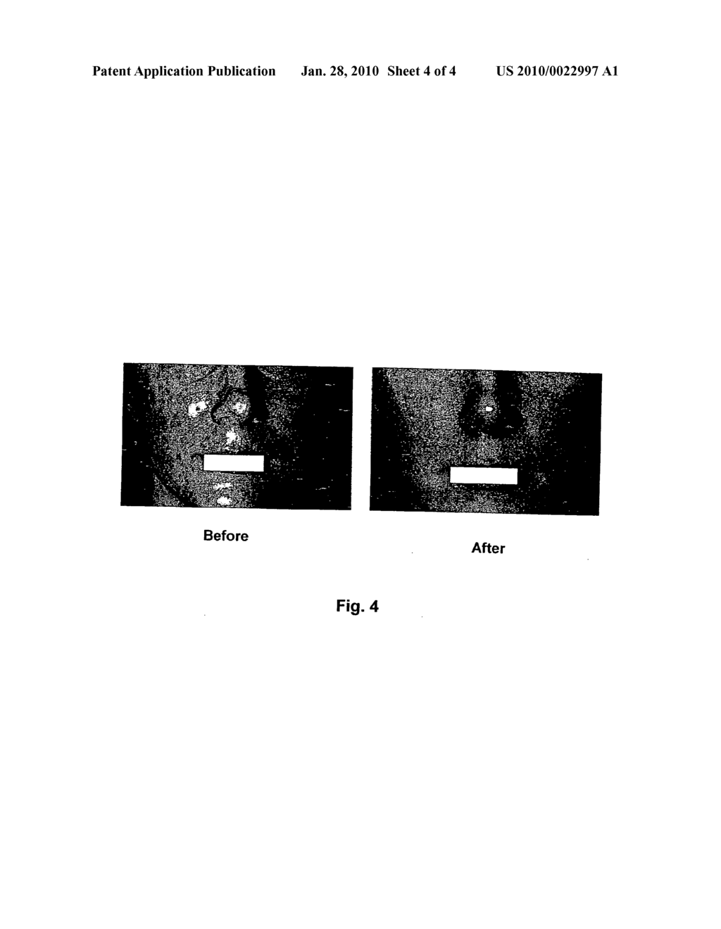 Method and process for producing youthful-appearing, small-pored, and smooth skin - diagram, schematic, and image 05