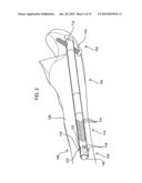 FRACTURE FIXATION DEVICE, TOOLS AND METHODS diagram and image