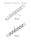 FRACTURE FIXATION DEVICE, TOOLS AND METHODS diagram and image