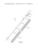 FRACTURE FIXATION DEVICE, TOOLS AND METHODS diagram and image