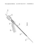 FRACTURE FIXATION DEVICE, TOOLS AND METHODS diagram and image