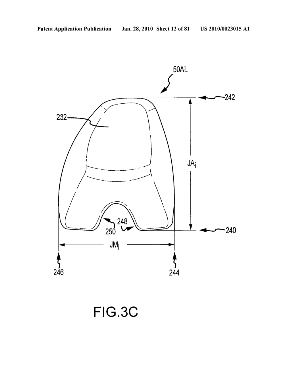 SYSTEM AND METHOD FOR MANUFACTURING ARTHROPLASTY JIGS HAVING IMPROVED MATING ACCURACY - diagram, schematic, and image 13