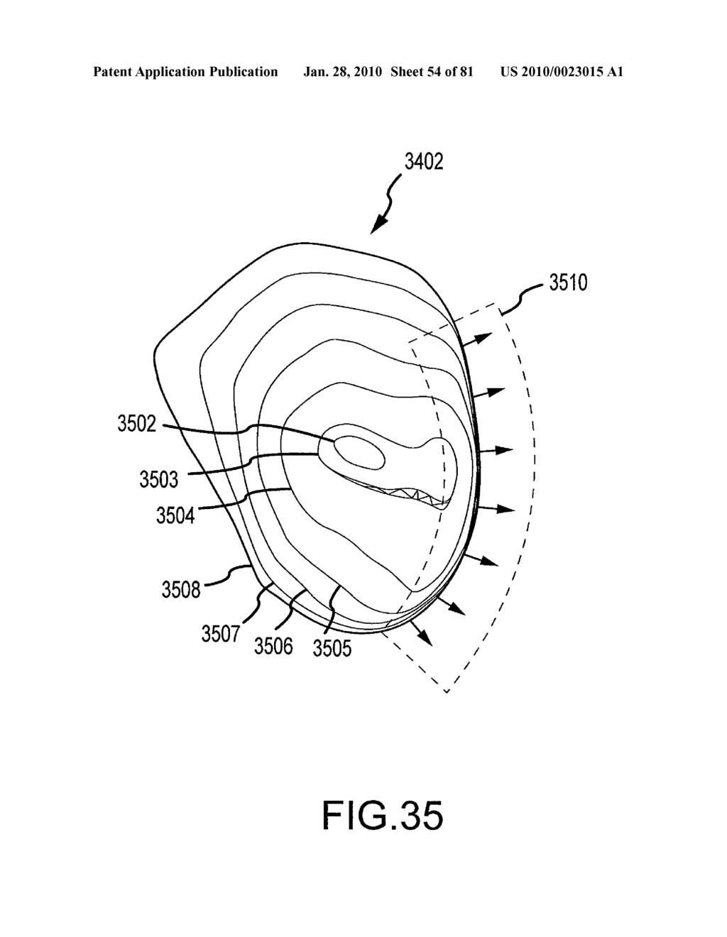 SYSTEM AND METHOD FOR MANUFACTURING ARTHROPLASTY JIGS HAVING IMPROVED MATING ACCURACY - diagram, schematic, and image 55