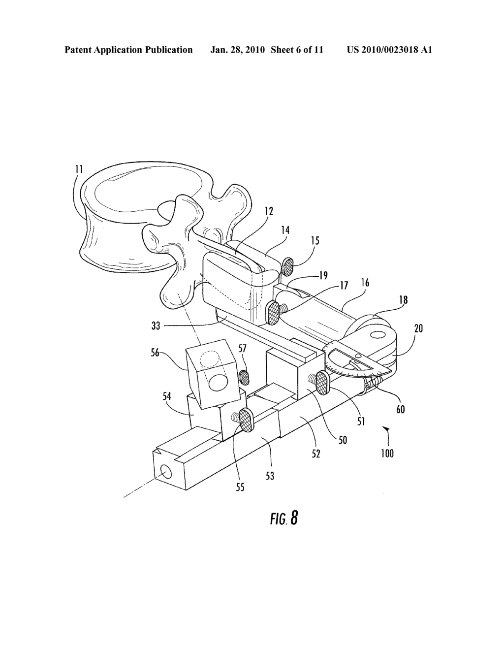 Spinous process fixated bilateral drilling guide - diagram, schematic, and image 07