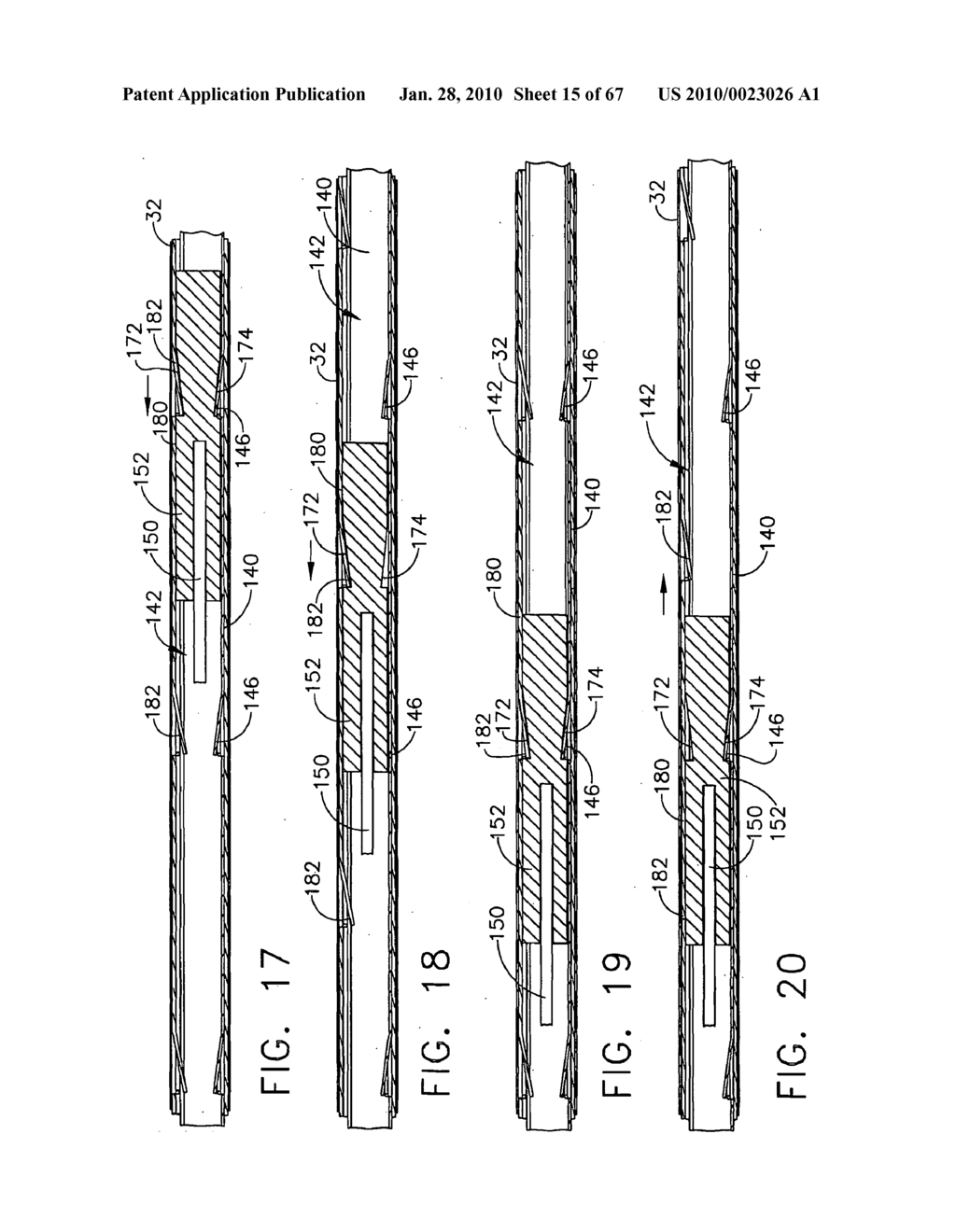 RELOADABLE LAPAROSCOPIC FASTENER DEPLOYING DEVICE WITH DISPOSABLE CARTRIDGE FOR USE IN A GASTRIC VOLUME REDUCTION PROCEDURE - diagram, schematic, and image 16