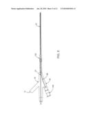 ULTRASOUND CATHETER AND METHODS FOR MAKING AND USING SAME diagram and image