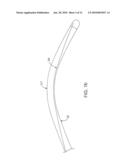 ULTRASOUND CATHETER AND METHODS FOR MAKING AND USING SAME diagram and image