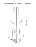 ULTRASOUND CATHETER AND METHODS FOR MAKING AND USING SAME diagram and image